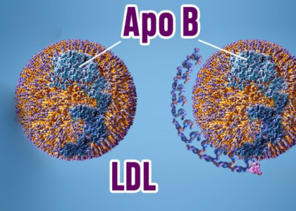 Difference Between LDL and ApoB