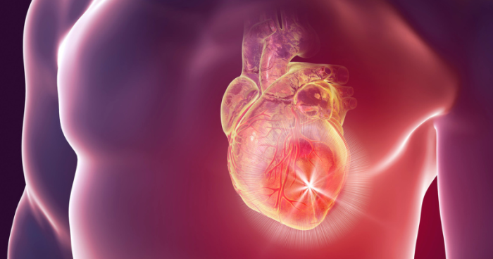 Rheumatic Heart Disease